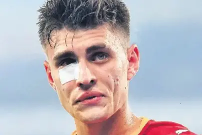 Çakmak atan holigana 1 yıl spordan men