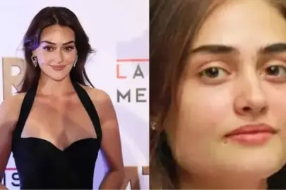 Esra Bilgiç estetik yaptırdı mı? Esra Bilgiç kimdir, kaç yaşında, nereli?