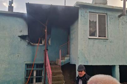 Ev yangınında yaralandı