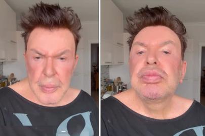 Kuşum Aydın estetik sonrası son halini paylaştı! Değişimi gündem oldu