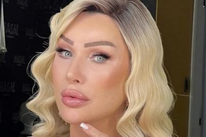 Seda Sayan estetik mi yaptırdı, yüzünde kaç tane estetik var? Seda Sayan yüzüne ne yaptırdı, kaç tane estetik operasyonu geçirdi?