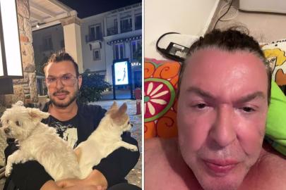 Yüzünü gerdiren Kuşum Aydın'ın son hali ortaya çıktı