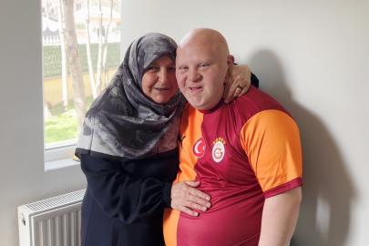 Down sendromlu annesinin sosyal alan ve anlayış isteği