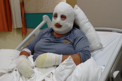Ardahan'da yangın dehşeti: 6 yaşındaki kızını alevlerin arasından böyle kurtardı